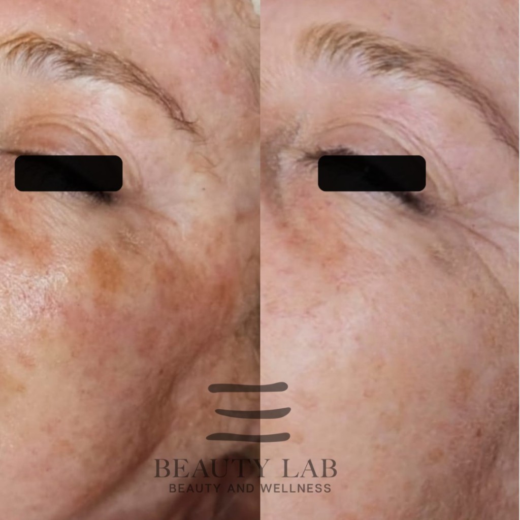 Risultato Skin Perfect 10