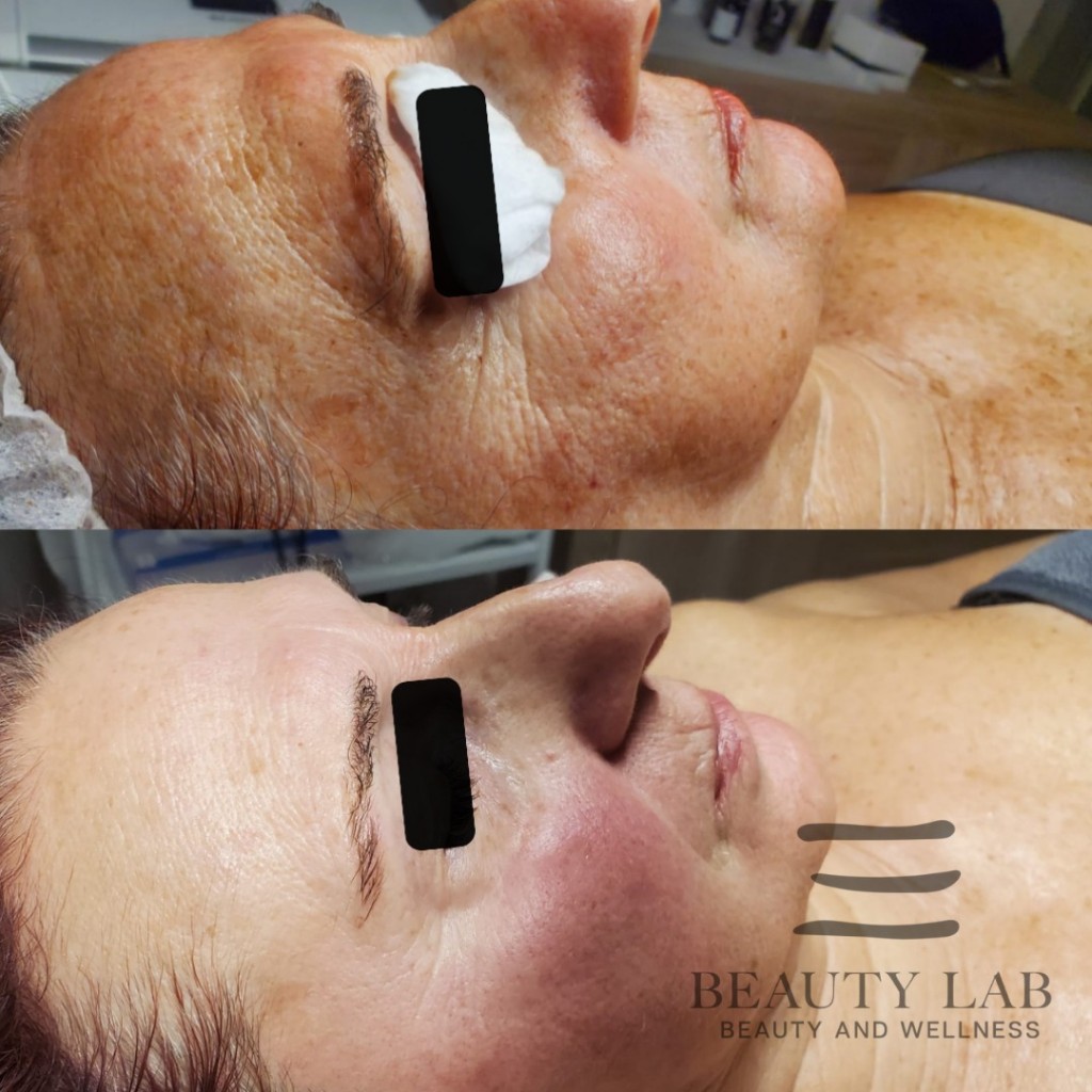 Risultato Skin Perfect 11