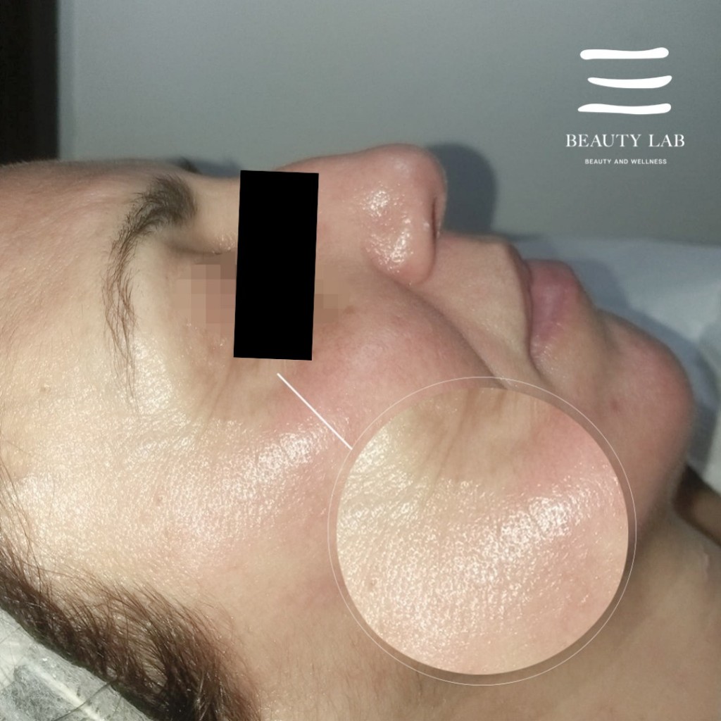 Risultato Skin Perfect 3