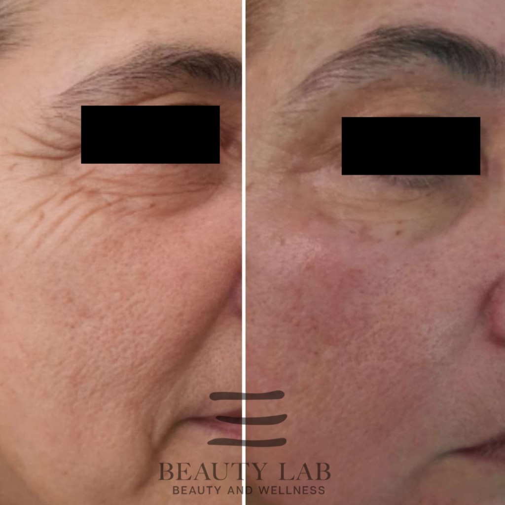 Risultato Skin Perfect 7