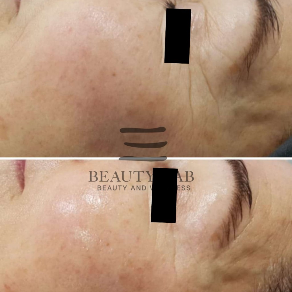 Risultato Skin Perfect 8