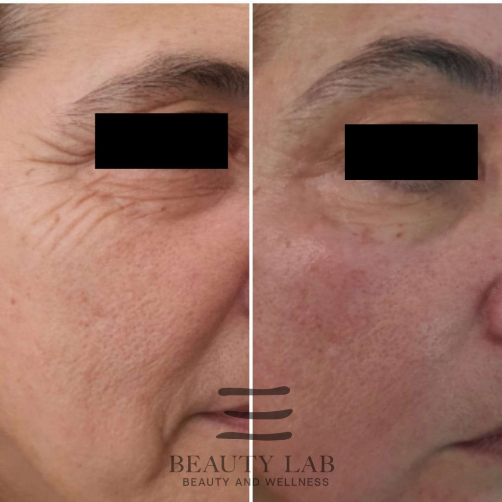 Risultato Skin Perfect 9