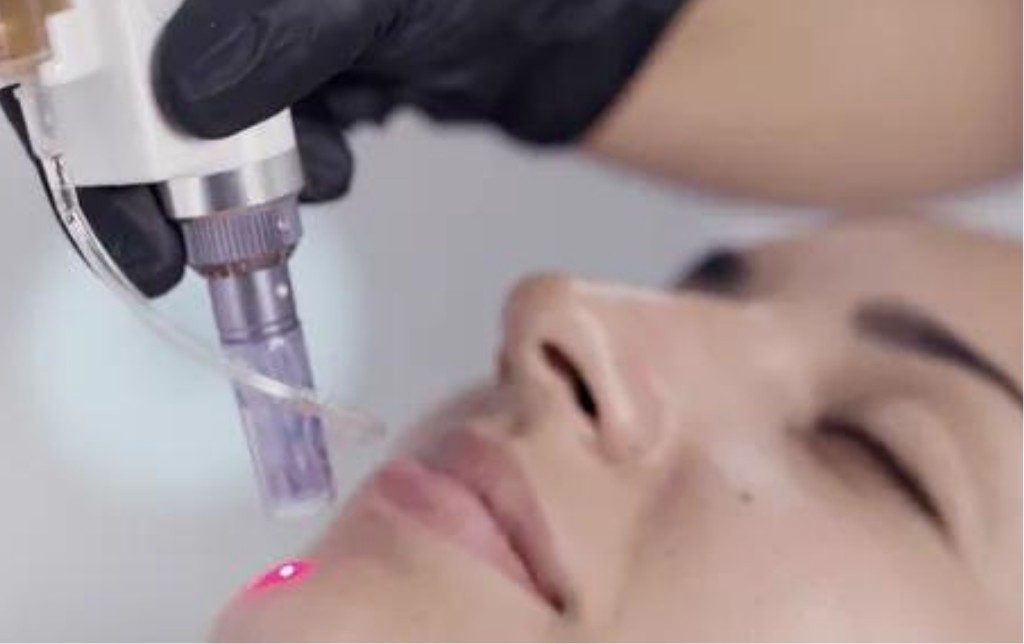 Veicolazione transdermica
